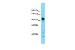 FAM91A1 Antibody, Novus Biologicals 100 &mu;L | Buy Online | Novus Biologicals | Fisher Scientific